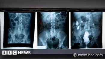 Unclear when patient scan system will be fixed