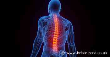 Doctor debunks common arthritis myth and explains how condition really develops