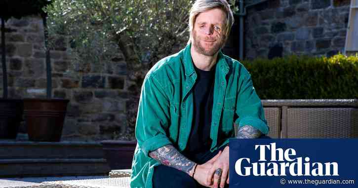 TV tonight: people with facial differences make a tough decision