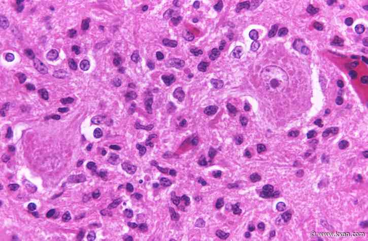 Raccoon in San Marcos tests positive for rabies, residents urged to vaccinate pets