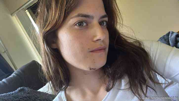 Paard trapt de kaak van Wendy doormidden: 'Liefde blijft onvoorwaardelijk'