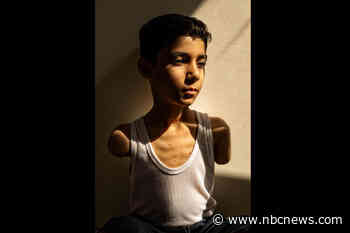 A moment of joy for a boy who lost both arms in an Israeli airstrike