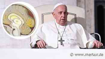Papst Franziskus starb an Schlaganfall – das sind die Symptome