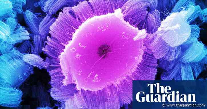 Top cancer experts ‘being put off UK by politicians’ messaging on immigration’