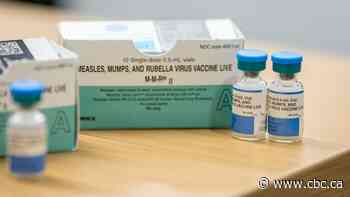 Confirmed measles cases in Edmonton region, Peace River prompt potential measles exposure warning