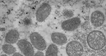 Mpox found in sewage samples from Greenville plant