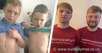 Willerby man running London Marathon for brother with heart condition