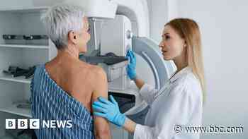 Low uptake for breast screening appointments