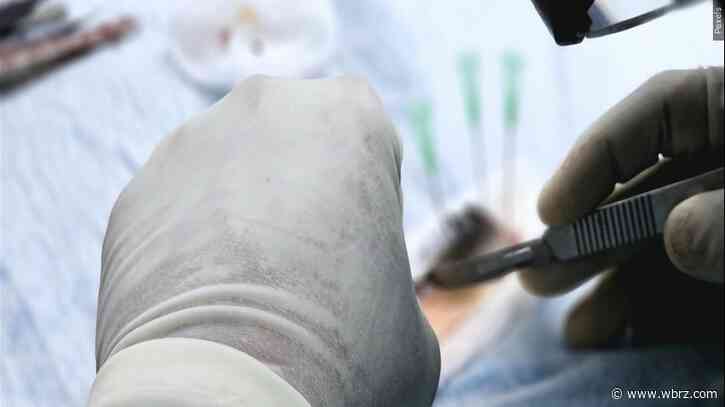 2 Your Health: Importance of organ donation highlighted by liver health