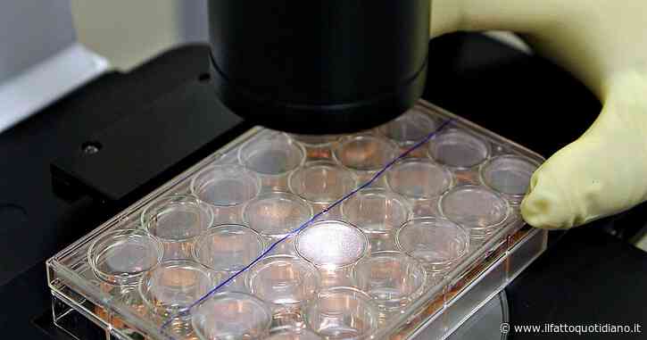 Leucodistrofia metacromatica, con la terapia genica alcuni bambini “hanno mantenuto la capacità di camminare”