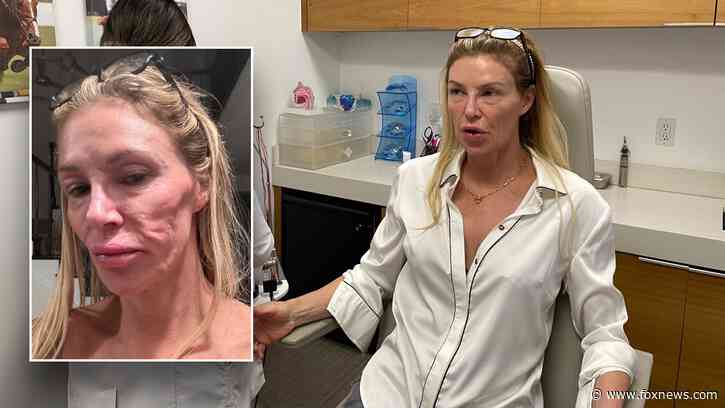 Brandi Glanville rushed to hospital while battling mystery illness that left her face disfigured