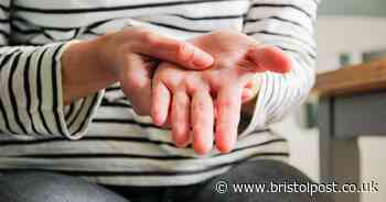 Lumps on the knuckles could be red flag sign of 'silent killer' condition - how to spot