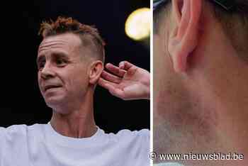 Boze Sam Gooris toont blauwe plek na optreden: “Van harte bedankt, je bent in je missie geslaagd”