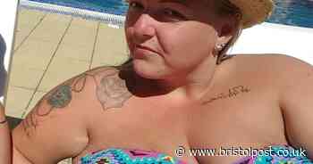 'I had to go to Turkey for £5,000 skin surgery after losing 9 stone'