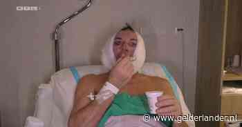 Gerard Joling verschijnt bont en blauw in serie door gezichtsoperatie: ‘Ik zie er natuurlijk vreselijk uit’