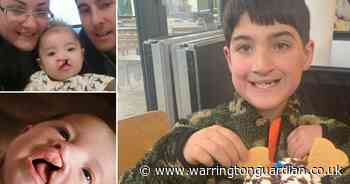 “My cleft is my difference – it’s a bit cool because it makes me unique”