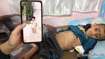 Children face starvation in Gaza as Israel's blockade of food, medication reaches 2 months