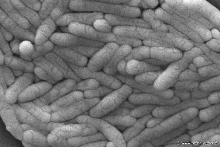 New salmonella outbreak is linked to backyard poultry, CDC says