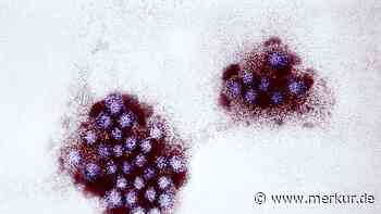 Norovirus-Verdacht in bayerischem Restaurant: Schwindel und Übelkeit bei fast 150 Gästen