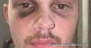 ‘My £300,000 ketamine addiction has ruined my life - now I am 24 with no bladder'