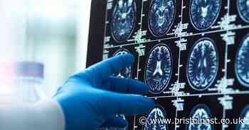 Working too hard physically changes shape of your brain, study shows
