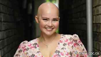 What women need to know about hair loss