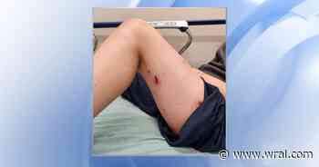 Dog attack at Wake County Animal Center leaves mother and daughter injured