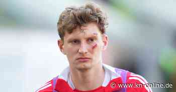 Skandal in Schottland: Fußballprofi von Sitzschale getroffen