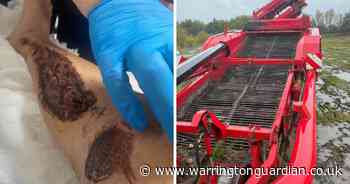 Business fined £20,000 after farm worker, 20, seriously injured by potato harvester