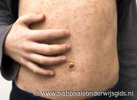 Leerling op basisschool in Middelburg besmet met mazelen
