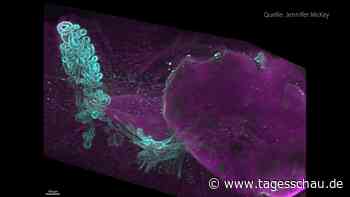 Teil des weiblichen Körpers wiederentdeckt