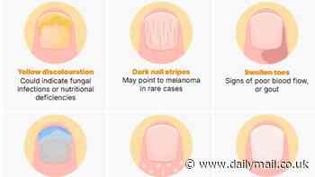 Revealed: What your TOENAILS say about you, according to experts