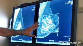 Sask. women 45+ can now self-refer for breast screening mammograms, but awareness, capacity issues continue