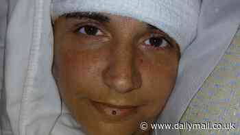 Paralyzed woman reveals shocking effect of Elon Musk's Neuralink brain chip