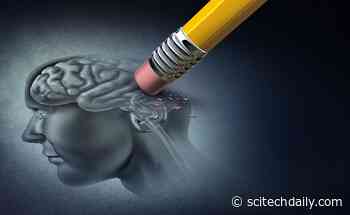 Scientists Reveal Biological Signal Behind Mysterious Alzheimer’s Drug Side Effect