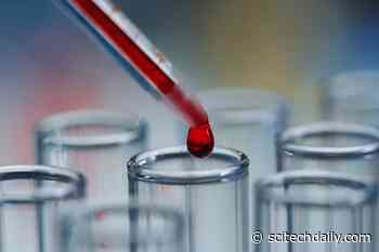 A Simple Blood Test Could Predict Dementia Risk 25 Years Early
