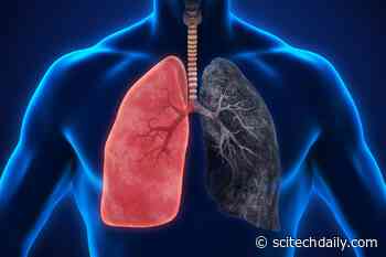 Why Aging Lungs Turn Mild Infections Into Life-Threatening Illness
