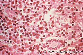 Hantavirus case confirmed near Southern Nevada