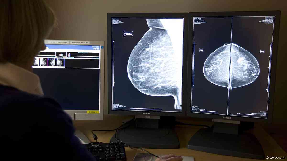 Miljoenen borstkankerpatiënten hebben volgens onderzoek geen chemo nodig