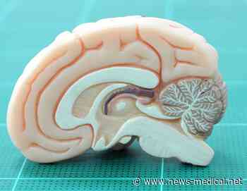 Targeted nerve stimulation boosts movement-related brain activity in humans