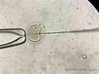 University of Aberdeen launches new patient-focused IVF success calculator