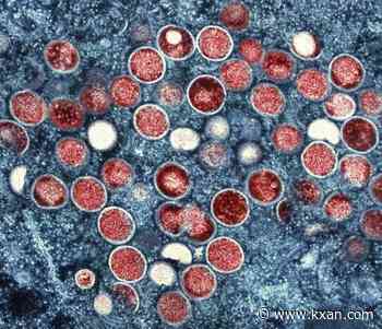 NIH researchers charged with trying to smuggle monkeypox into US: DOJ
