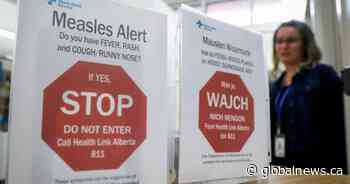Calgary medical clinic site of potential measles exposure, province says