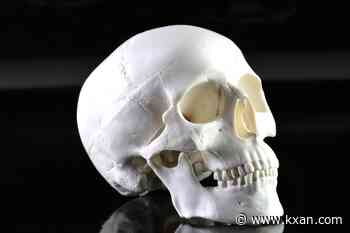 It's illegal to buy and sell human bones in Texas, but what about owning them?