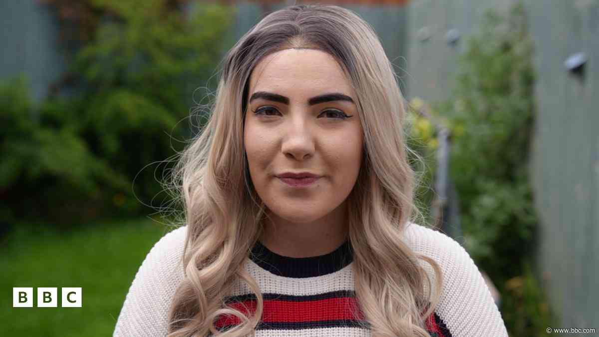 Epilepsi: 'Dwi wedi cael fy ngwrthod ar gyfer 300 swydd mewn blwyddyn'