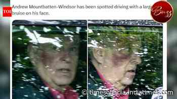Andrew's SHOCKING Facial Bruise Triggers Questions, Palace Insider Responds | WATCH