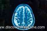 Lab-Grown Brains Could One Day Help Reawaken Nerve Regeneration