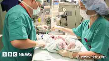 One in four births in England is now emergency caesarean, BBC analysis shows