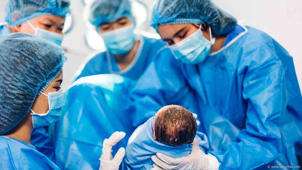 One in four births in England are now delivered by emergency caesarean - far higher than in other countries