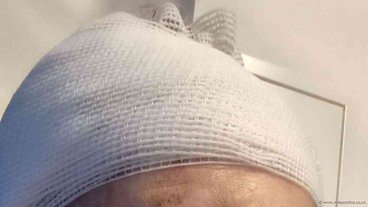 E-scooter rider hunts mystery hero who drove her to hospital after pothole crash